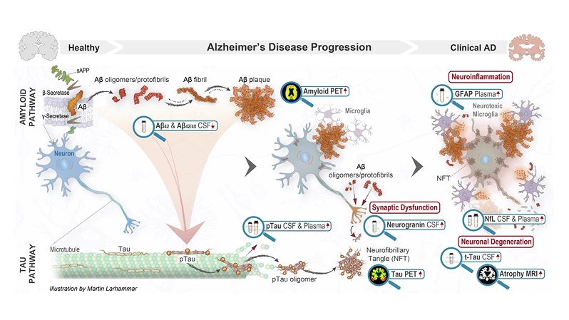 Biomarkører i klinisk praksis