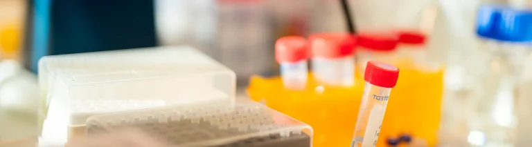 Biomarkörer vid Alzheimers sjukdom hero