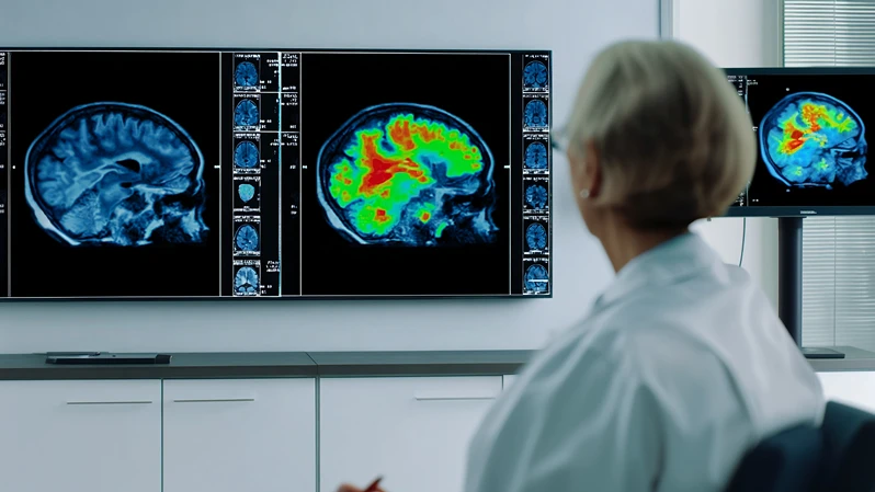 Fra klinisk syndrom til biologisk definert diagnose med biomarkører