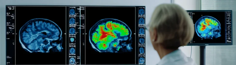 Från kliniskt syndrom till biologiskt definierad diagnos med biomarkörer hero